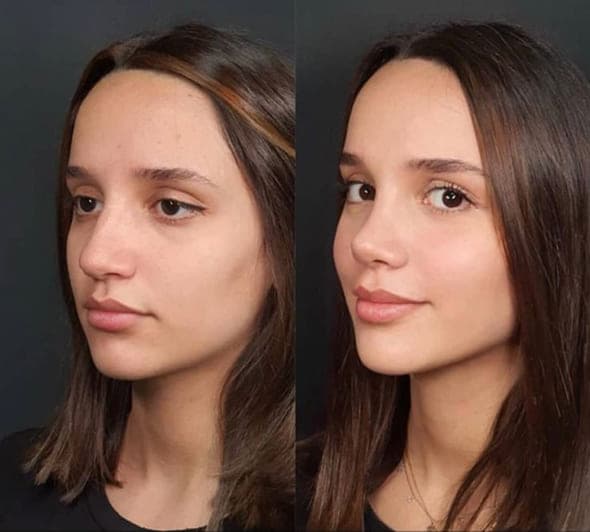 Комплексные случаи
